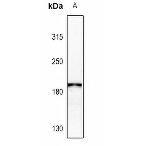 Collagen 4 alpha 2 Rabbit Polyclonal Antibody