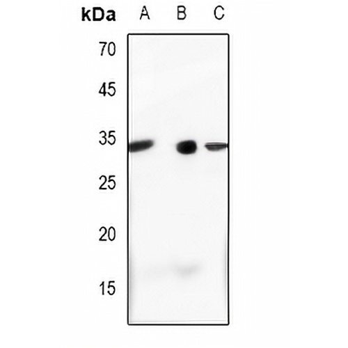 Complement C1S LC Rabbit Polyclonal Antibody