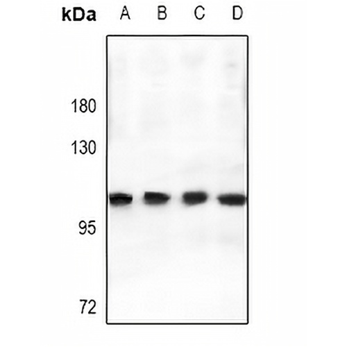 MMP9 Rabbit Polyclonal Antibody