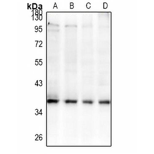 GPR42 Rabbit Polyclonal Antibody