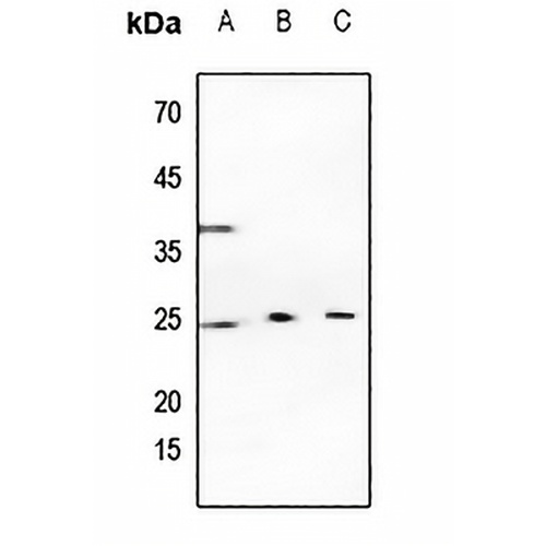 Cathepsin K Rabbit Polyclonal Antibody