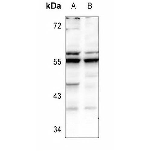 Fetuin B Rabbit Polyclonal Antibody