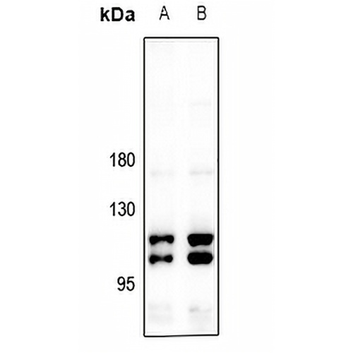 CIITA Rabbit Polyclonal Antibody