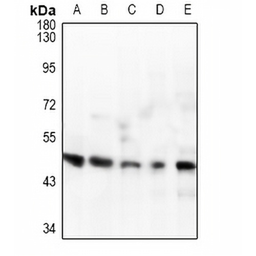 IL-1R2 Rabbit Polyclonal Antibody