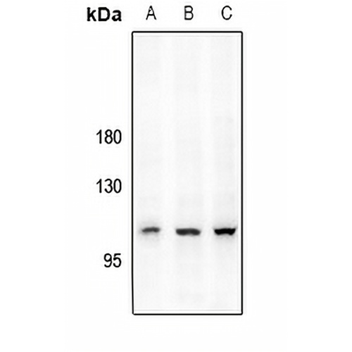 CD167a (Phospho-Y792) Rabbit Polyclonal Antibody