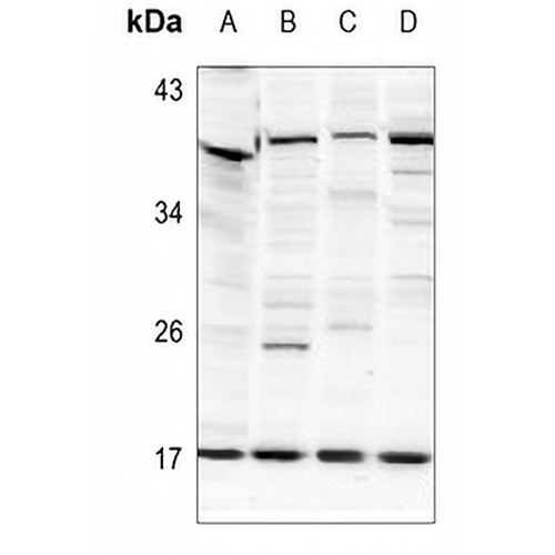 Histone H2B (Acetyl-K125) Rabbit Polyclonal Antibody
