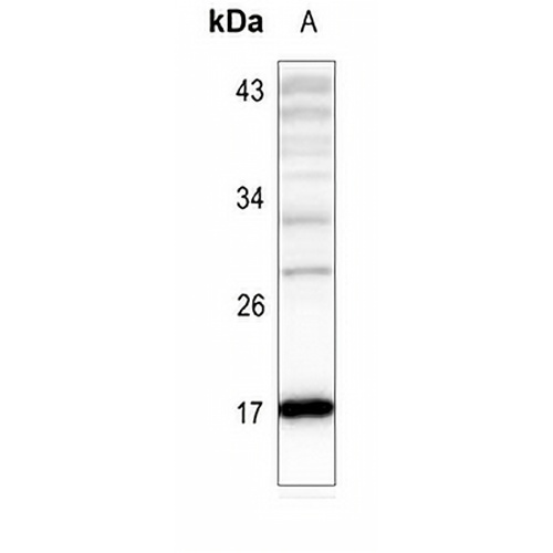 Histone H3 (Acetyl-K4) Rabbit Polyclonal Antibody