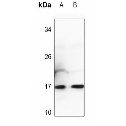 Histone H3 (MonoMethyl-K27) Rabbit Polyclonal Antibody