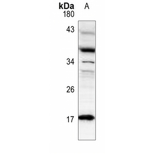 Histone H3 (DiMethyl-K79) Rabbit Polyclonal Antibody