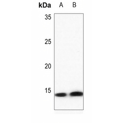 Histone H4 (DiMethyl-K20) Rabbit Polyclonal Antibody