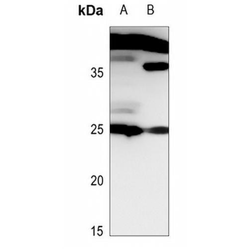 Histone H1 Rabbit Polyclonal Antibody