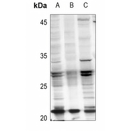 RAB21 (Acetyl-K109) Rabbit Polyclonal Antibody