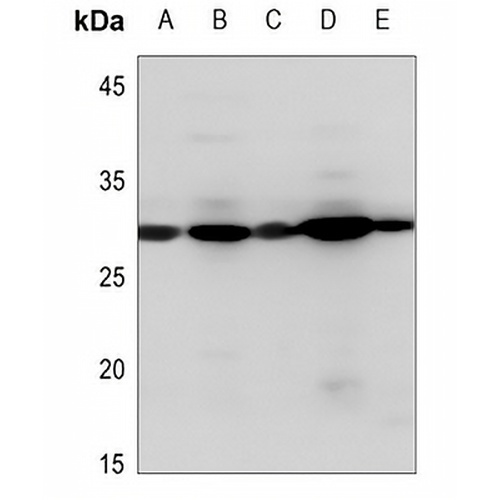 PDGFB Rabbit Polyclonal Antibody