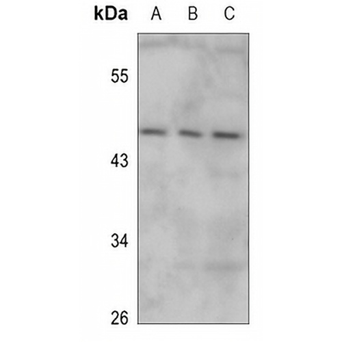 IRX1 Rabbit Polyclonal Antibody