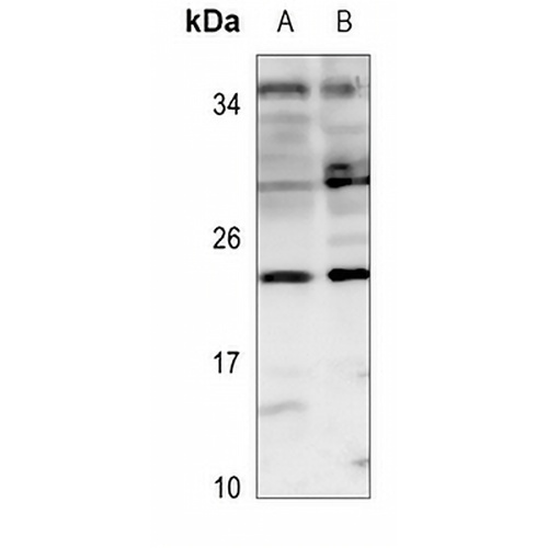Claudin 6 Rabbit Polyclonal Antibody
