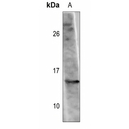 Histone H2A.Z (Acetyl-K11) Rabbit Polyclonal Antibody