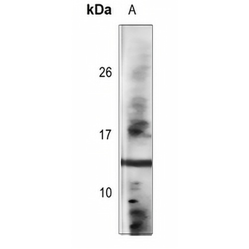 Histone H2B (Acetyl-K120) Rabbit Polyclonal Antibody