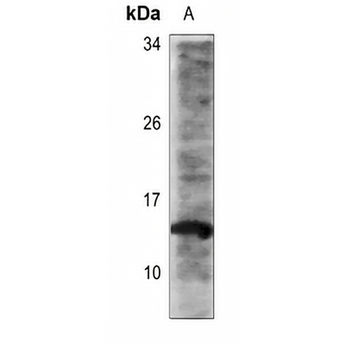 Histone H2B (Acetyl-K16) Rabbit Polyclonal Antibody