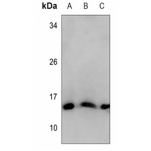 Histone H2A (Acetyl-K118) Rabbit Polyclonal Antibody