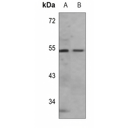 PTEN (Acetyl-K402) Rabbit Polyclonal Antibody