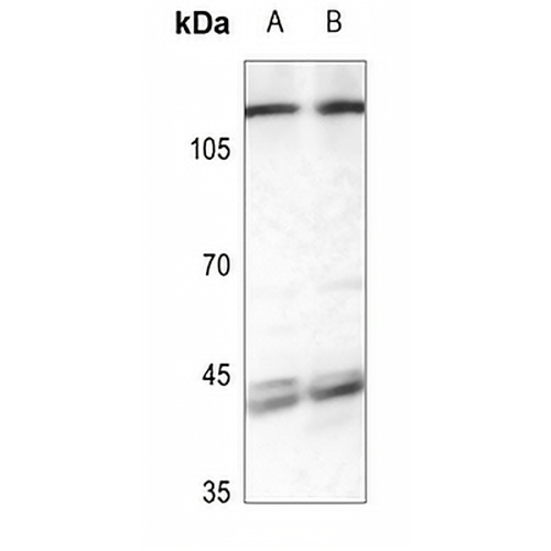 CLCN7 Rabbit Polyclonal Antibody