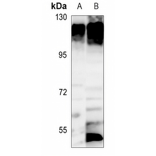 ATP1A1 Rabbit Polyclonal Antibody