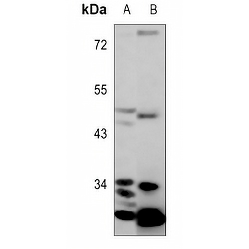 TTC35 Rabbit Polyclonal Antibody