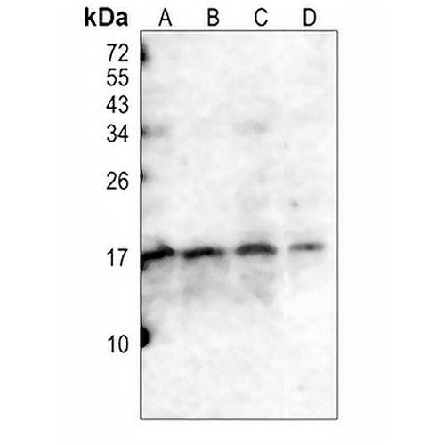 CD247 (Phospho-Y142) Rabbit Polyclonal Antibody