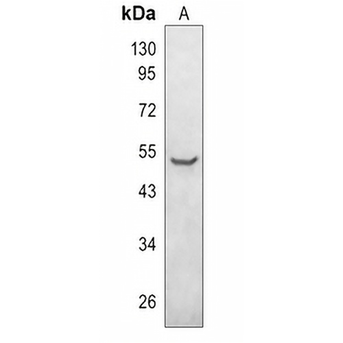Parkin (Phospho-S131) Rabbit Polyclonal Antibody