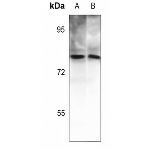PKC theta (Phospho-T538) Rabbit Polyclonal Antibody