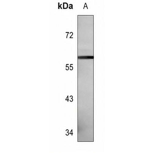 CD129 (Phospho-S519) Rabbit Polyclonal Antibody