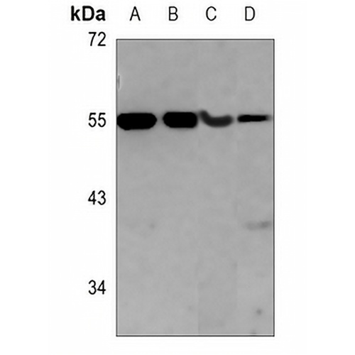 Kir5.1 (Phospho-S416) Rabbit Polyclonal Antibody