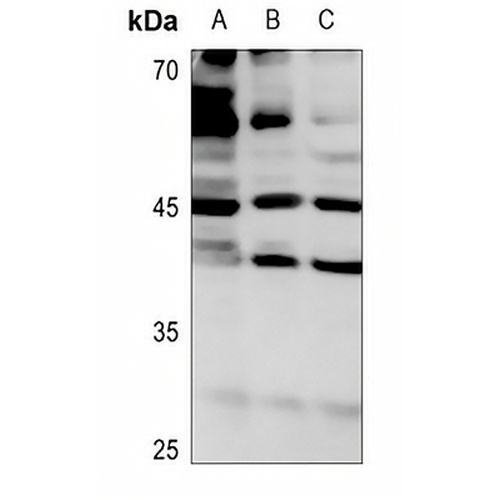 ROMK1 (Phospho-S44) Rabbit Polyclonal Antibody