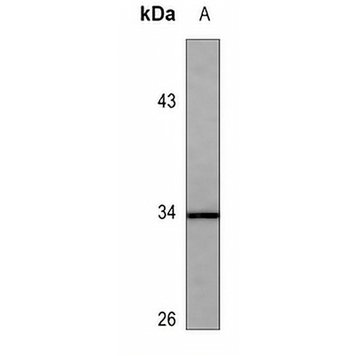 CDK2 (Phospho-T160) Rabbit Polyclonal Antibody