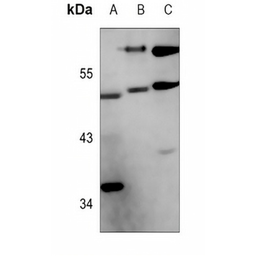 FOXO4 (Phospho-S262) Rabbit Polyclonal Antibody