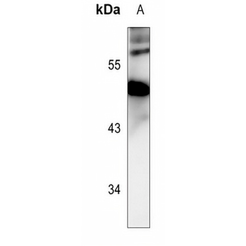 PRAK (Phospho-T182) Rabbit Polyclonal Antibody