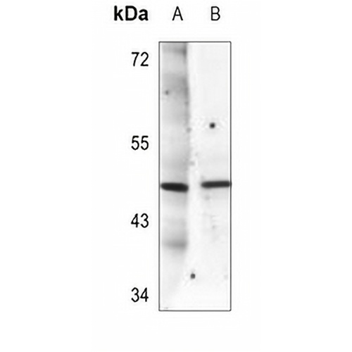 SGK1 (Phospho-T256) Rabbit Polyclonal Antibody