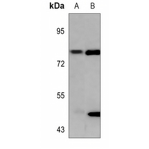 PKC gamma (Phospho-T655) Rabbit Polyclonal Antibody