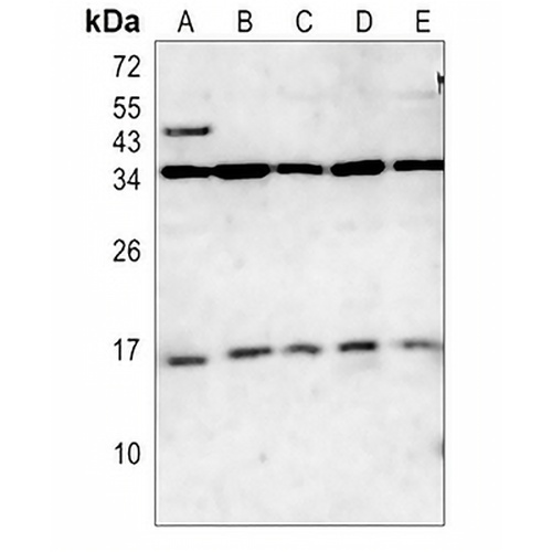CD247 Rabbit Polyclonal Antibody
