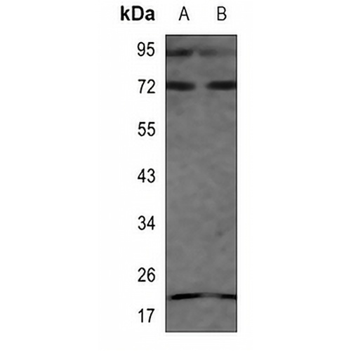 S6K1 Rabbit Polyclonal Antibody