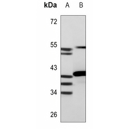 HOXA1/B1/D1 Rabbit Polyclonal Antibody