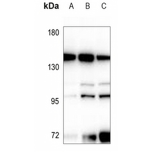 DGK delta Rabbit Polyclonal Antibody