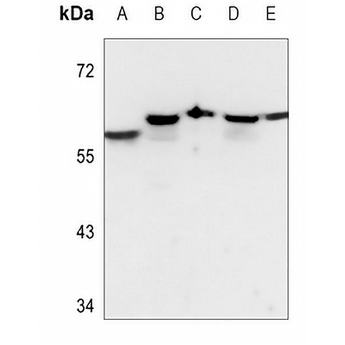 DAK Rabbit Polyclonal Antibody
