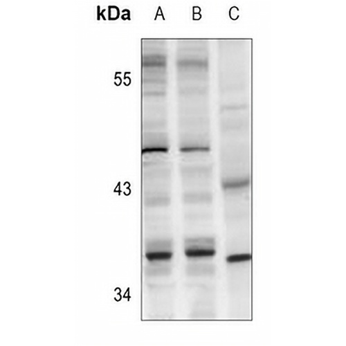 CTU1 Rabbit Polyclonal Antibody