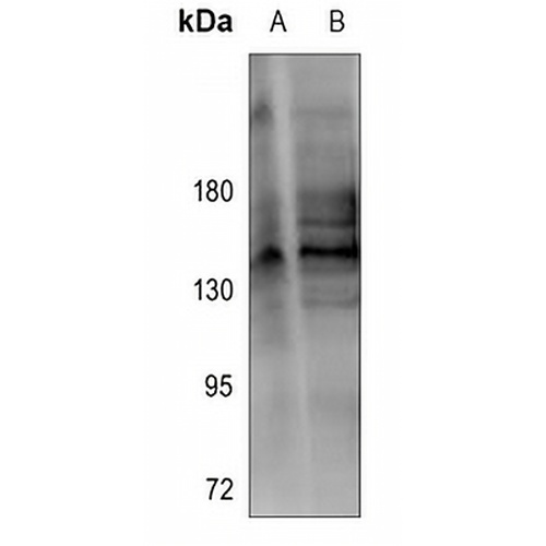 RGAG1 Rabbit Polyclonal Antibody
