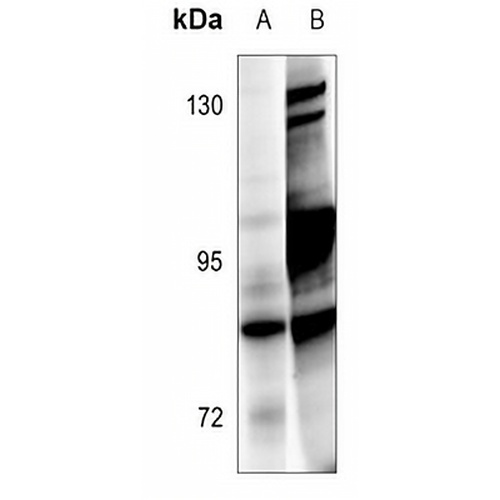BRSK1 Rabbit Polyclonal Antibody