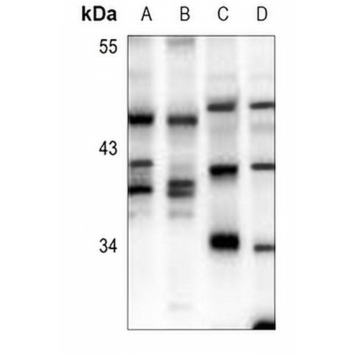 DOK4 Rabbit Polyclonal Antibody