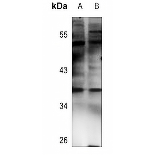 NT5C3 Rabbit Polyclonal Antibody
