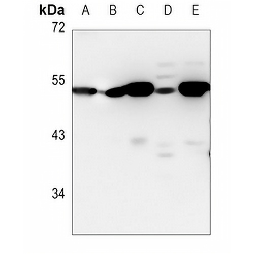 ZNHIT6 Rabbit Polyclonal Antibody