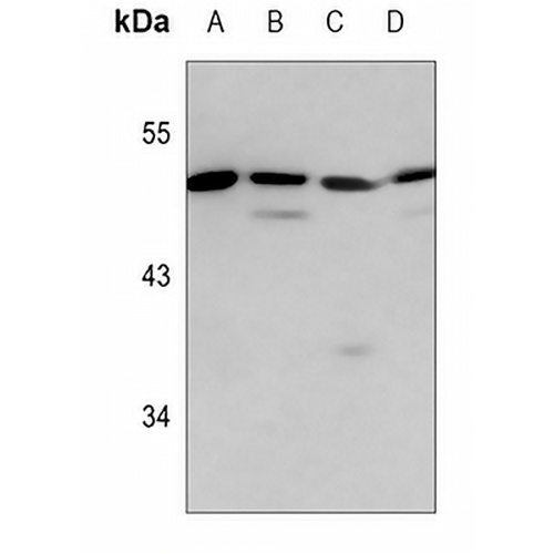 HSFX1 Rabbit Polyclonal Antibody